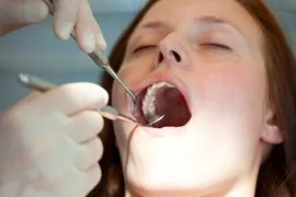 Teeth Cleaning