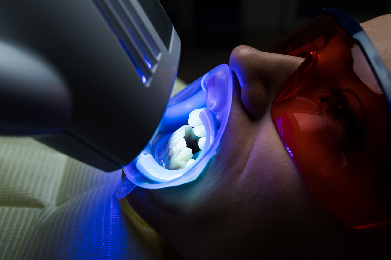 Adult female receiving teeth whitening procedure.portrait of a female patient at dentist in the clinic. Teeth whitening procedure with ultraviolet light UV lamp. LED lamp for Teeth whitening procedure