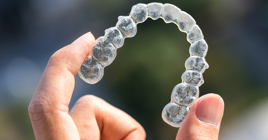 invisalign braces